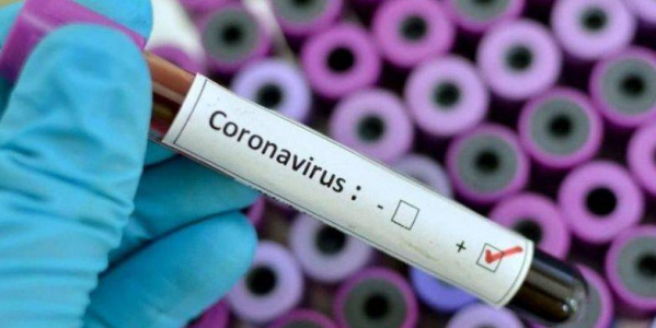 FIRES informa: Medidas Preventivas Coronavirus (Covid19)