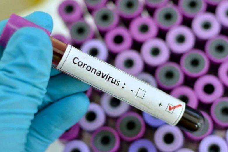 Medidas Preventivas Coronavirus (Covid19)